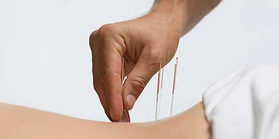 Link nach: Akupunktur