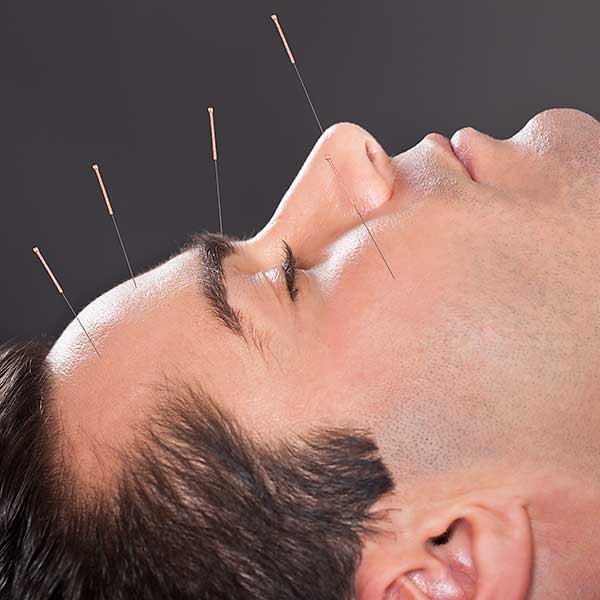 Akupunktur bei Anosmie