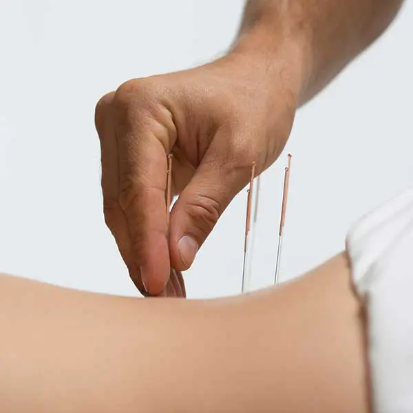Akupunktur in Koeln
